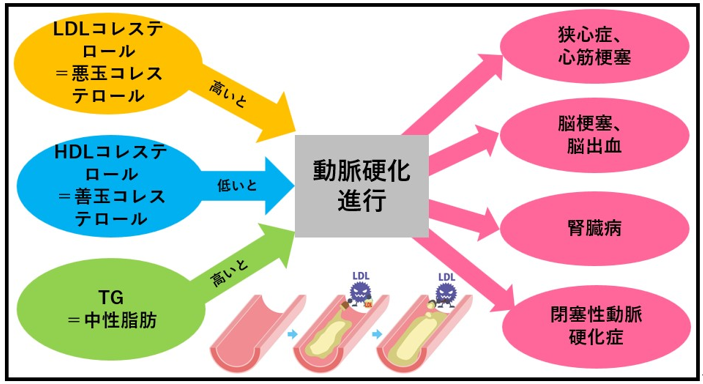 前糖尿病および高コレステロールの人が食べるべき食品